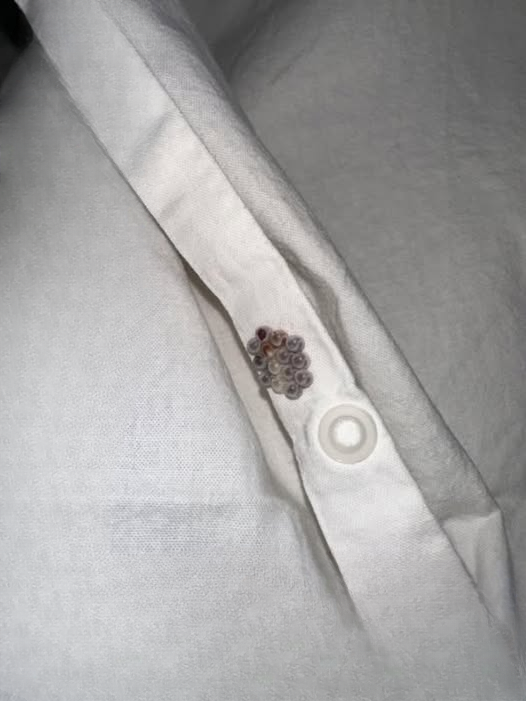 Tiny Eggs on Your Sheets? Here’s What You’re Actually Dealing With