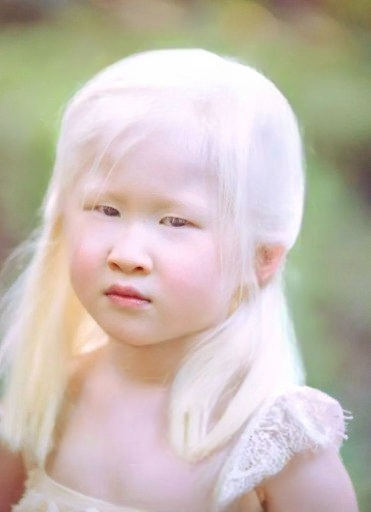 From Abandonment to Global Recognition: The Inspiring Story of Xueli Abbing