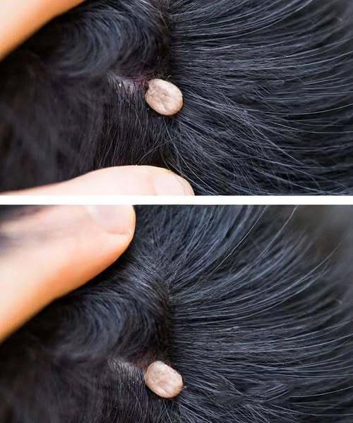 A Mysterious Lump in My Child’s Hair Turned Our Routine Upside Down