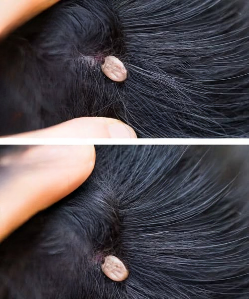 I Found Something Strange in My Son’s Hair — Here’s What It Turned Out to Be