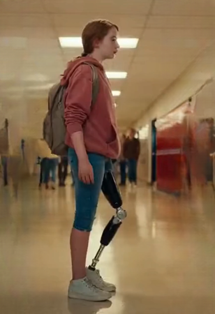 They Mocked Me for My Prosthetic Leg — But Then the Black SUVs Showed Up.