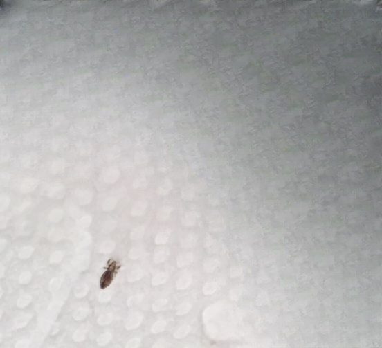 Found a Bug in Your Hair? How to Get Rid of It