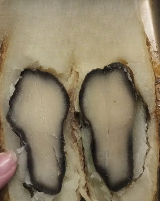 Why Do Potatoes Sometimes Have Black Rings Inside? Understanding the Cause and What to Do About It