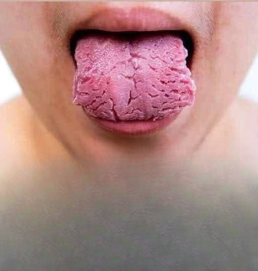 What Changes in Your Tongue May Reveal About Your Overall Well-Being