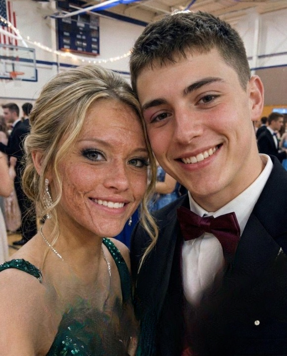 A Prom Dance That Changed Everything: Facing the Truth About a Childhood Fire