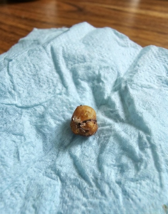 The Night a Tiny Creature Fell From Her Hair: What We Thought Was a Horror Story Turned Out to Be Something Far More Ordinary—But Deeply Unsettling