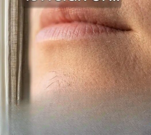 What a Single Chin Hair Could Be Telling You About Your Health (And Why You Shouldn’t Ignore It)