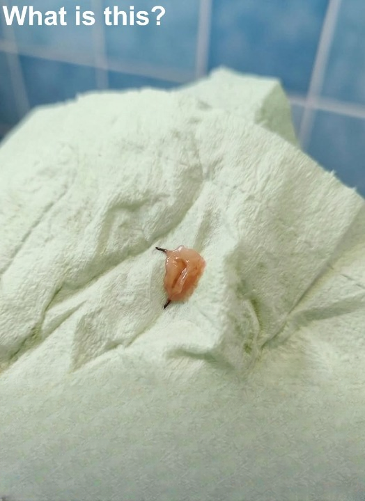 The Tiny “Monster” in My Shower That Turned Out to Be Nothing at All